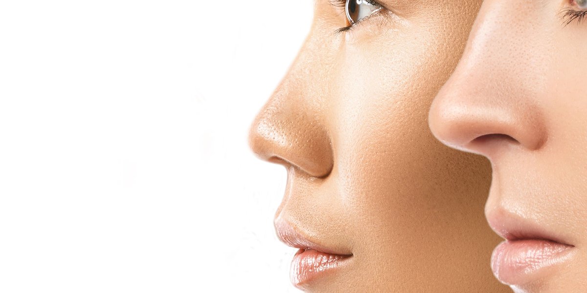 Two women with naturally radiant, healthy skin